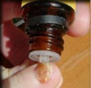 Aplikace kapek na nehet postižený plísní