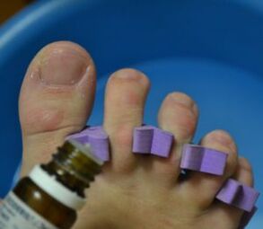 Příprava na ošetření nehtů kapkami proti plísním